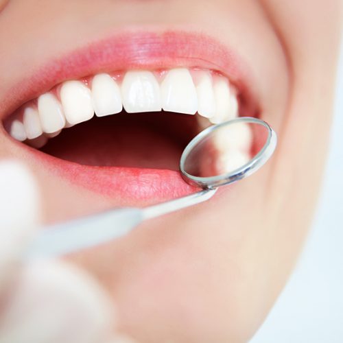 Implantes dentales en Chamberí - Baquero Odontología Familiar-3