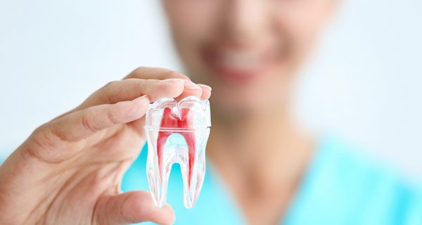 Blanqueamiento Dental en Chamberí - Baquero Odontología Familiar-4