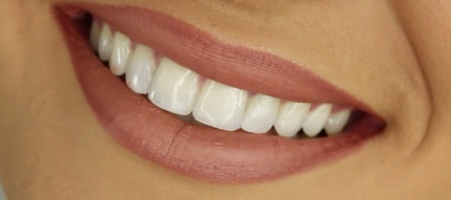 Seguro dental para tratamientos de salud bucal en Madrid