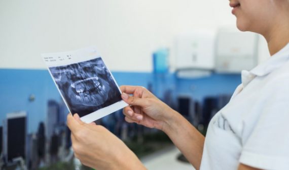 seguro dental para radiografias madrid