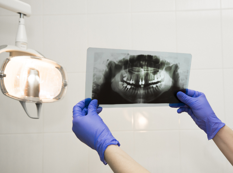 ¿Cubre el seguro dental las radiografías intraorales?