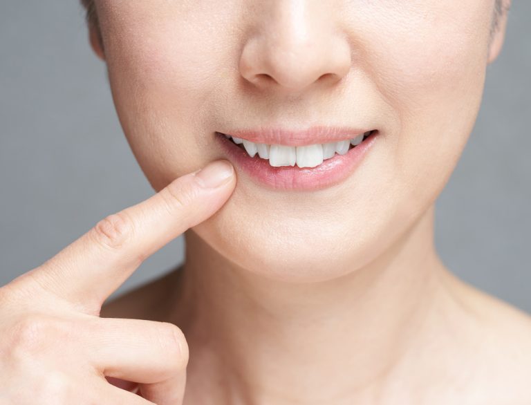 Qué es el surco nasogeniano