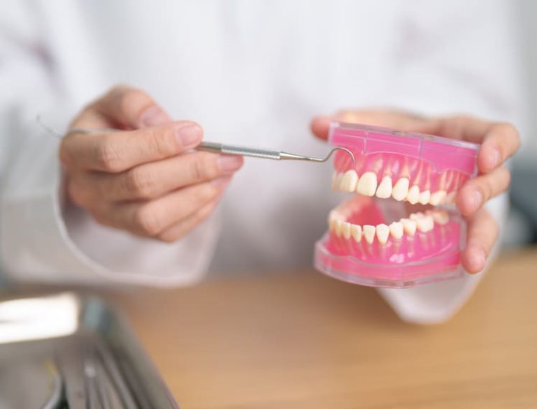 que es el raspado dental